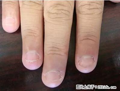 剪指甲、挖耳屎，这些日常小动作竟隐藏大危害！ - 衢州生活资讯 - 衢州28生活网 quzhou.28life.net